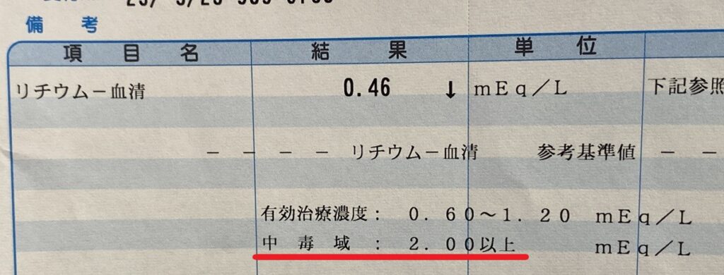 リチウム血中濃度