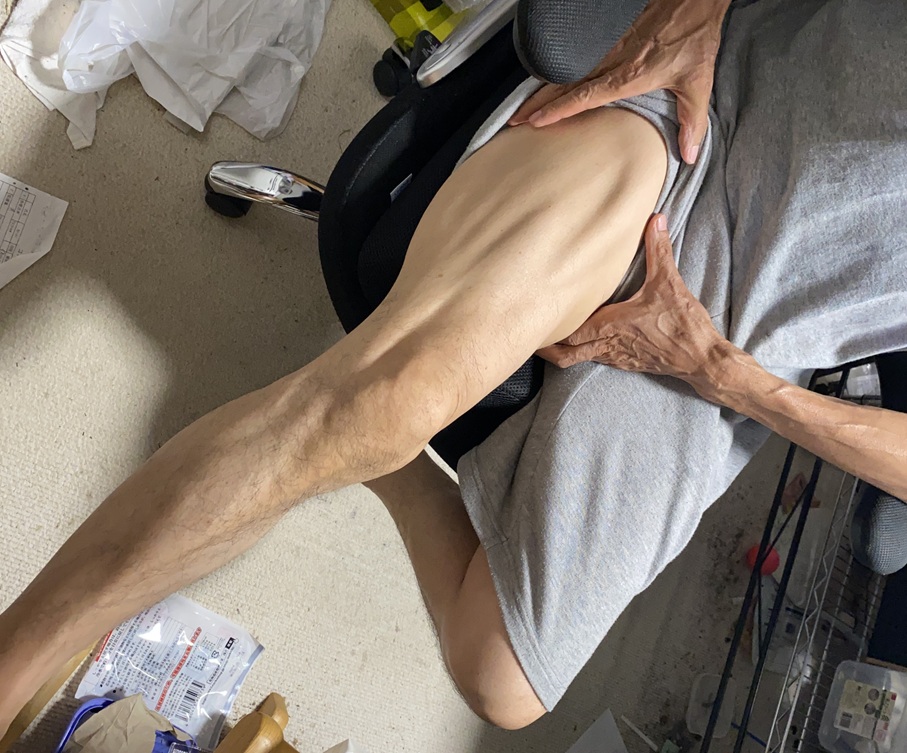 大腿四頭筋