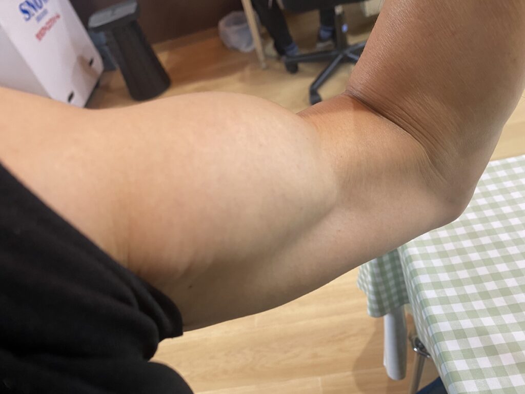 上腕二頭筋
